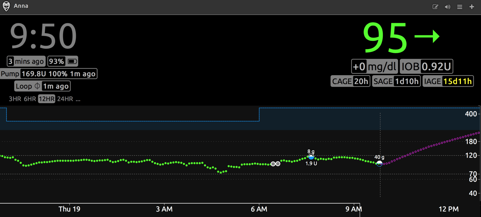 Basal Open Loop