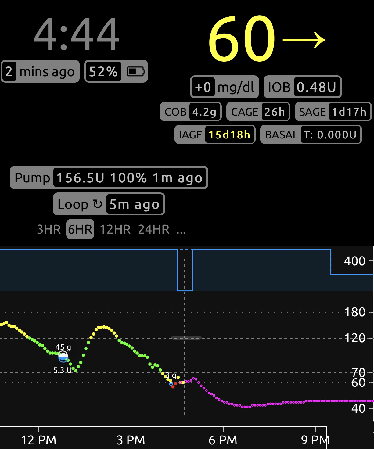 Carb Ratio 2